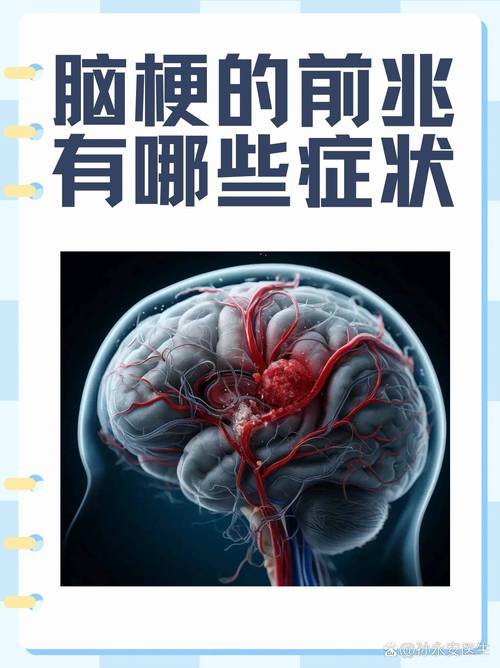 脑梗 血管堵塞65%