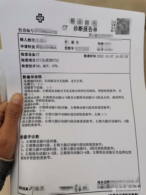 脑梗 影像手术 费用