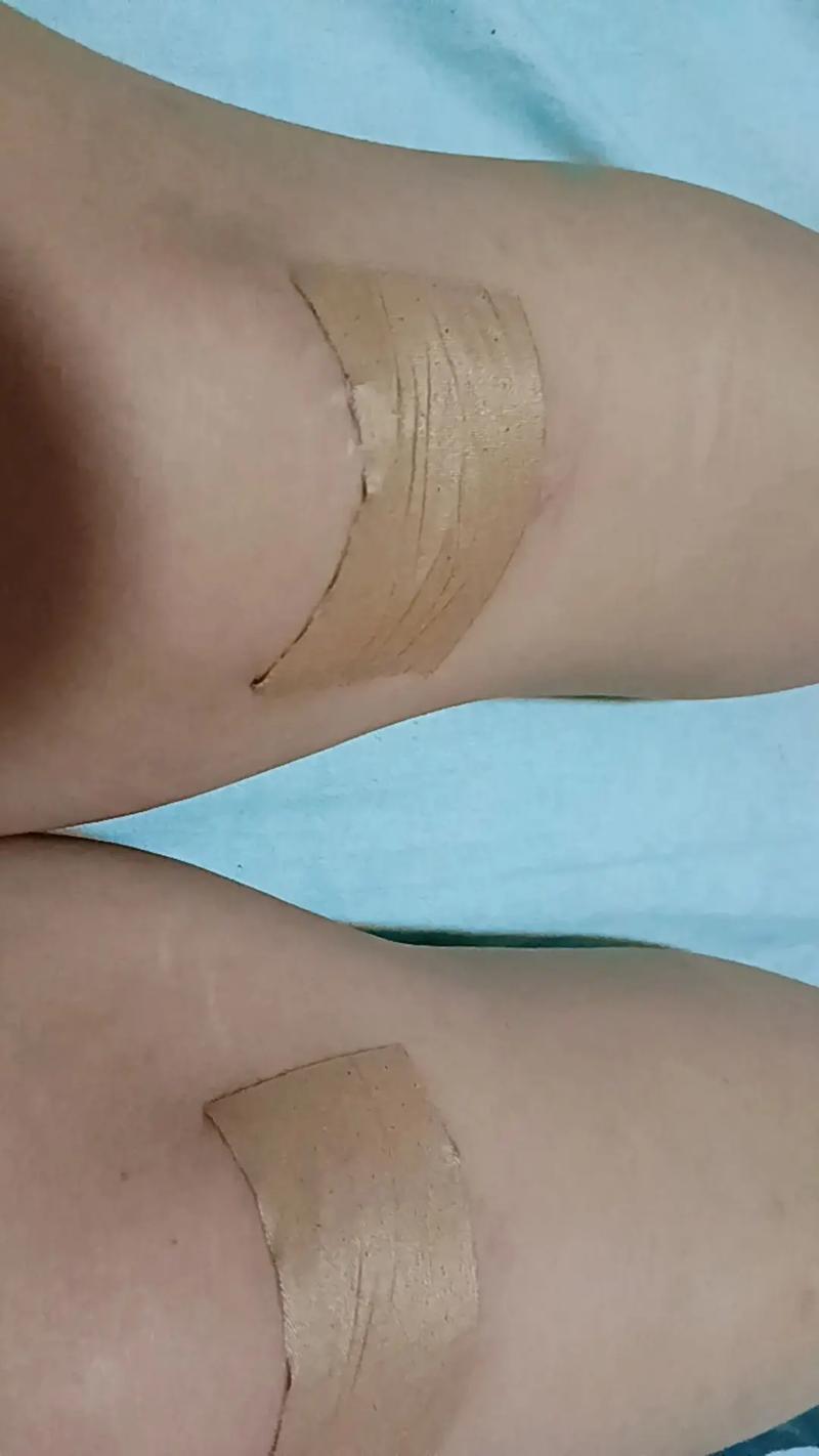 治疗内风湿云南风湿消