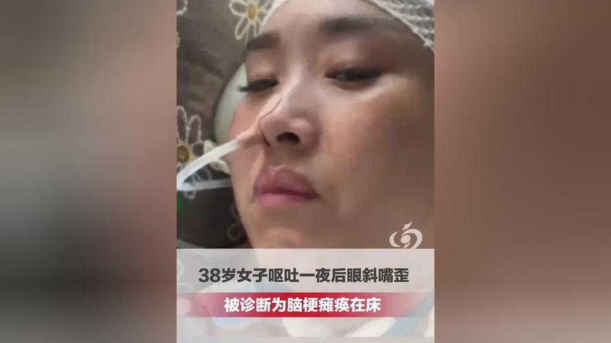 眼皮痉挛 脑梗 昏迷