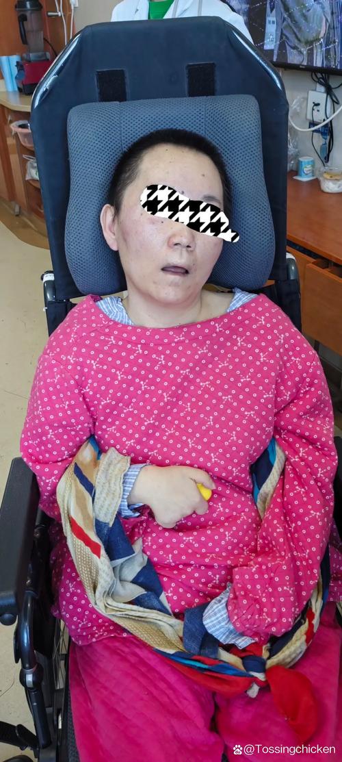 眼皮痉挛 脑梗 昏迷