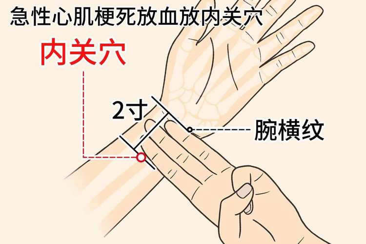 心肌缺血按摩什么穴位