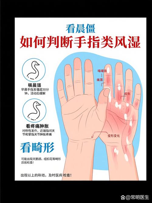 怎样诊断风湿和类风湿