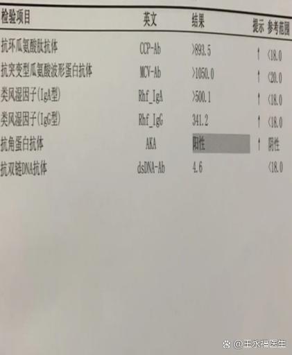 类风湿血沉多高算风湿