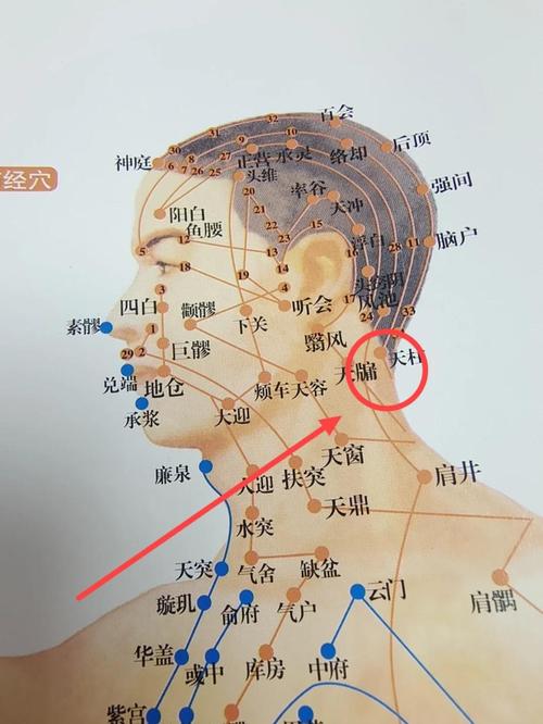 脖子落枕了按什么穴位