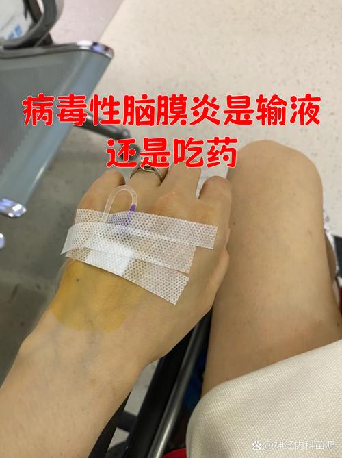 输液能预防脑梗心梗吗