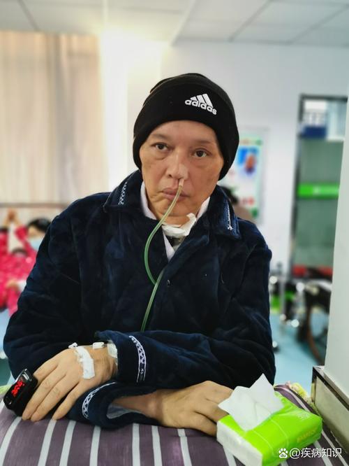 脑梗引发了脑疝手术后