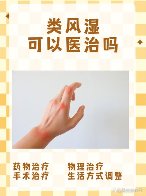 类风湿风湿可以治好吗