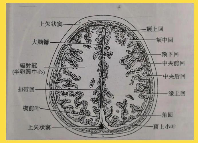 脑组织卵圆中心脑梗的