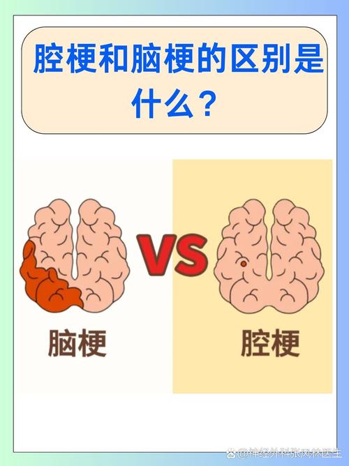 腔梗和脑梗哪个爱复发