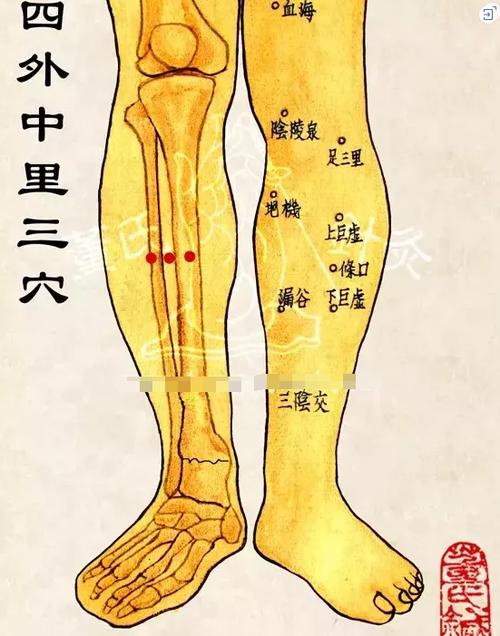 小腿酸痛针灸什么穴位