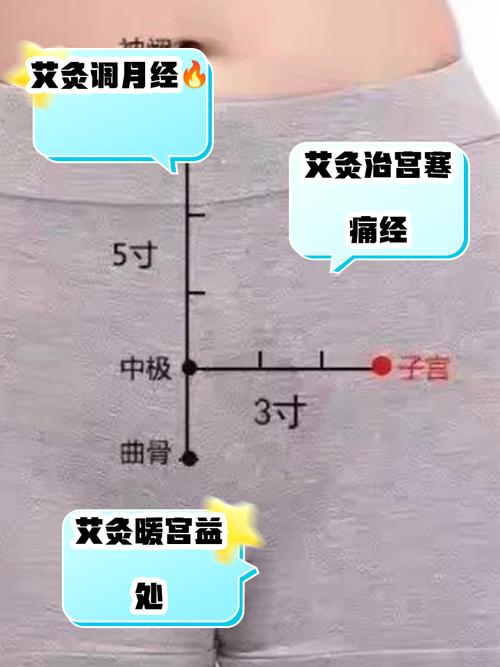 艾灸哪些穴位可以保胎