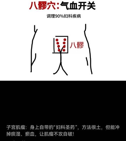 子宫肌瘤按摩那些穴位