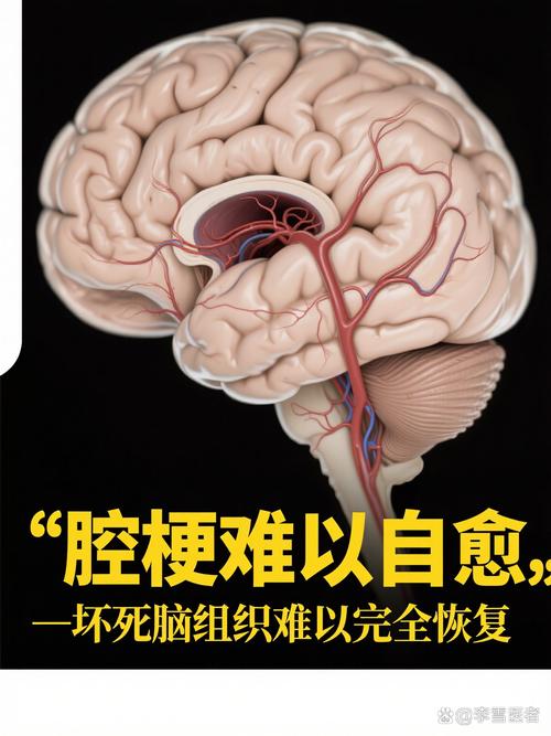 轻微脑梗和腔梗的区别