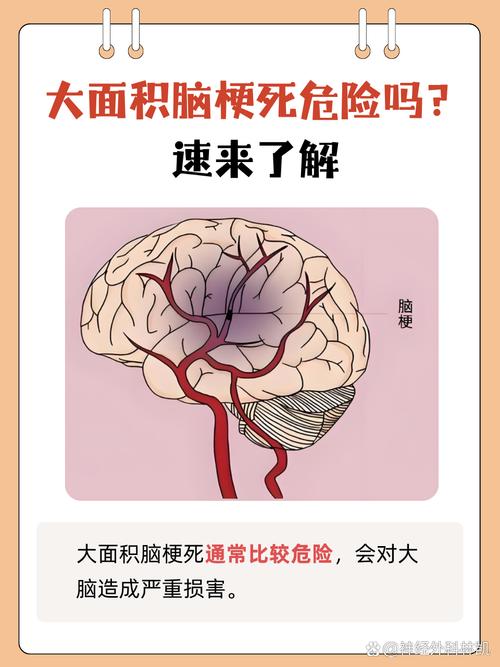 总害怕自己得脑梗心梗