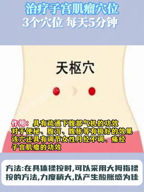 什么穴位治疗子宫肌瘤