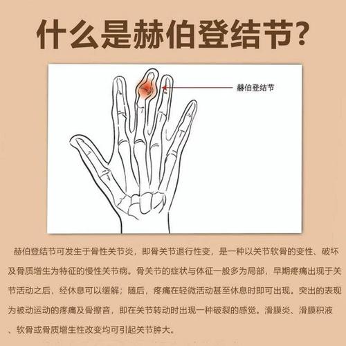 风湿类风湿骨变形秘方