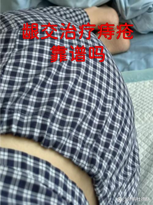 龈交穴位治疗痔疮视频