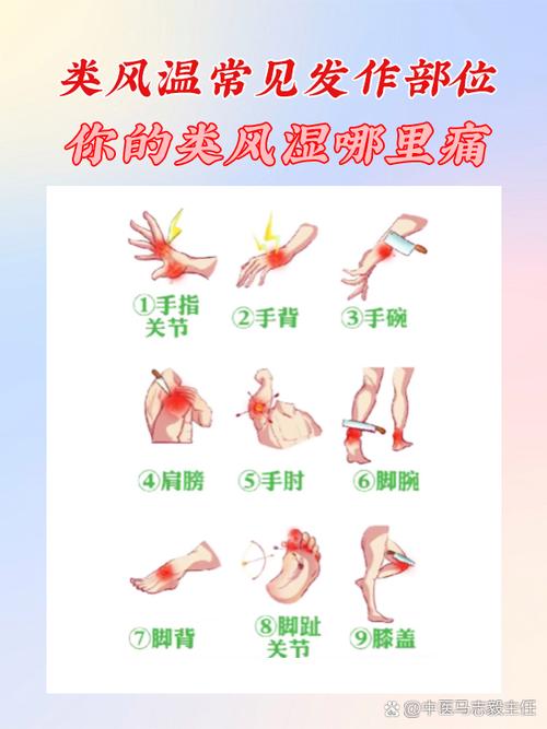 风湿和类风湿累及部位