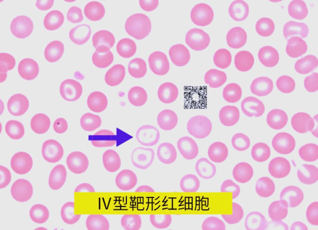 失明 脑梗 靶向细胞