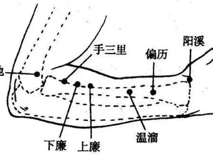 风湿性关节炎治疗穴位