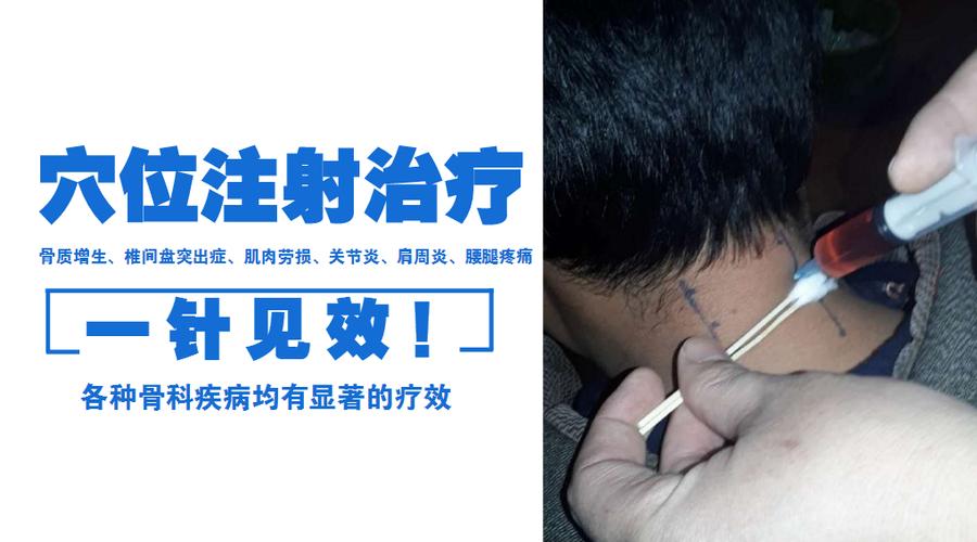 坐骨神经痛的穴位注射