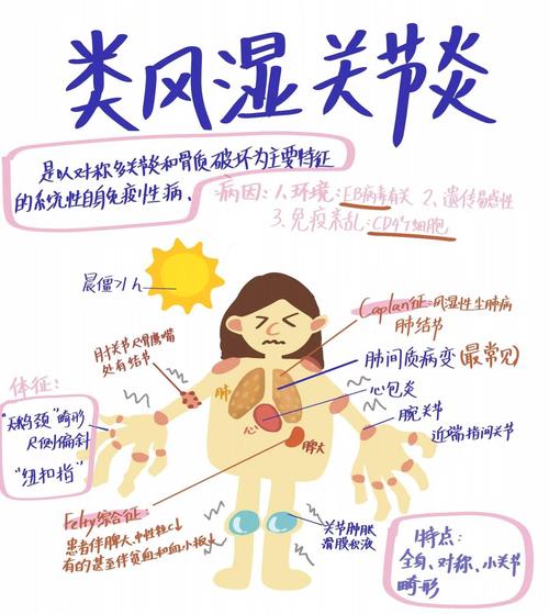 风湿类风湿的鉴别诊断