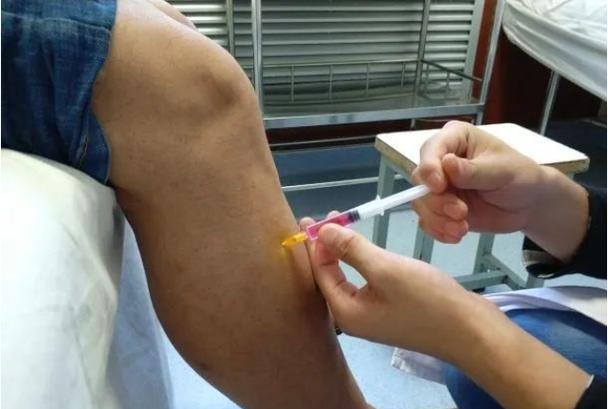 穴位注射治疗支气管炎