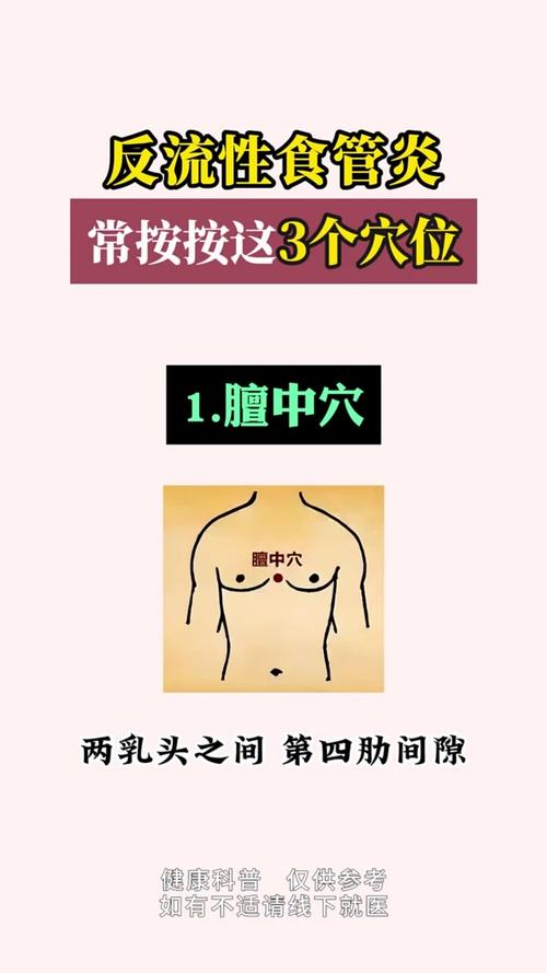 反流性食管炎按摩穴位