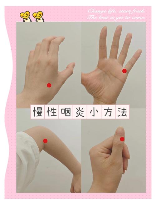 扁桃体发炎灸哪个穴位