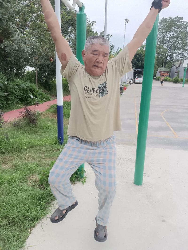 得完心梗脑梗恢复之后