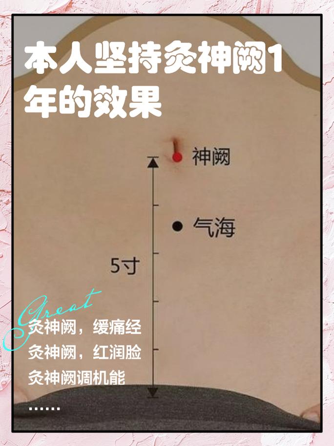 植物神经紊乱艾灸穴位