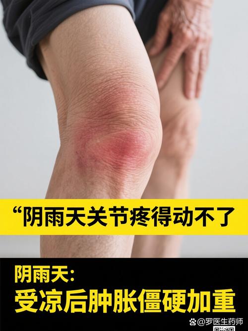 风湿类风湿怕冷浑身疼