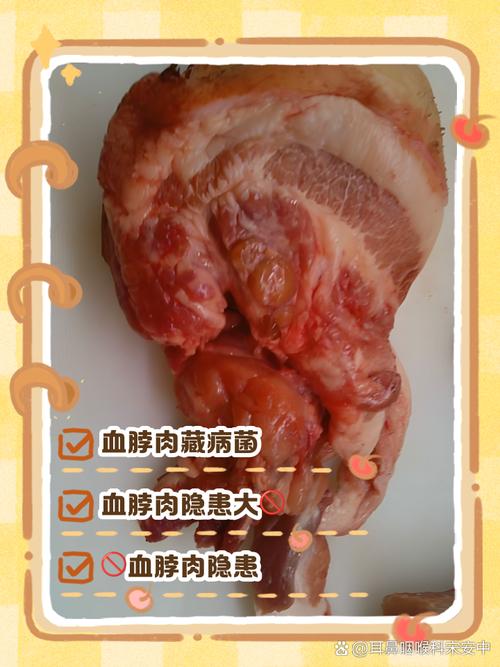 风湿类风湿能吃猪肉吗