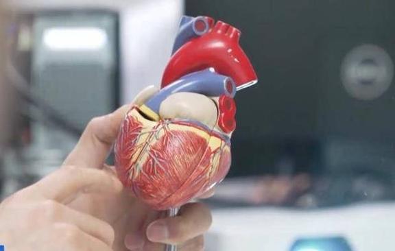 脑梗脑内放支架多少钱