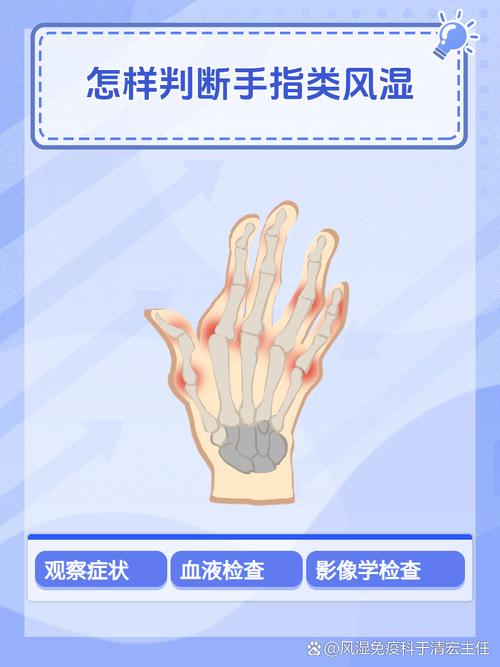 怎么辨别风湿和类风湿