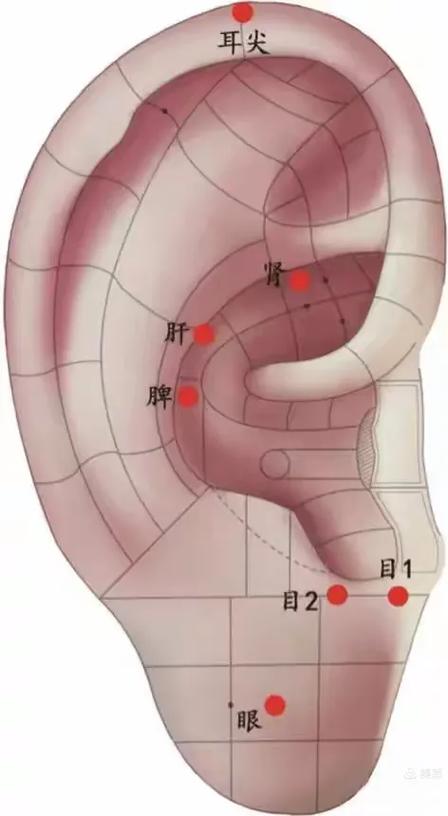 按摩耳朵穴位治疗近视