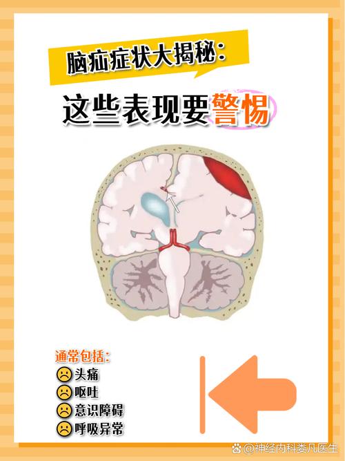 小脑脑梗会导致脑疝吗