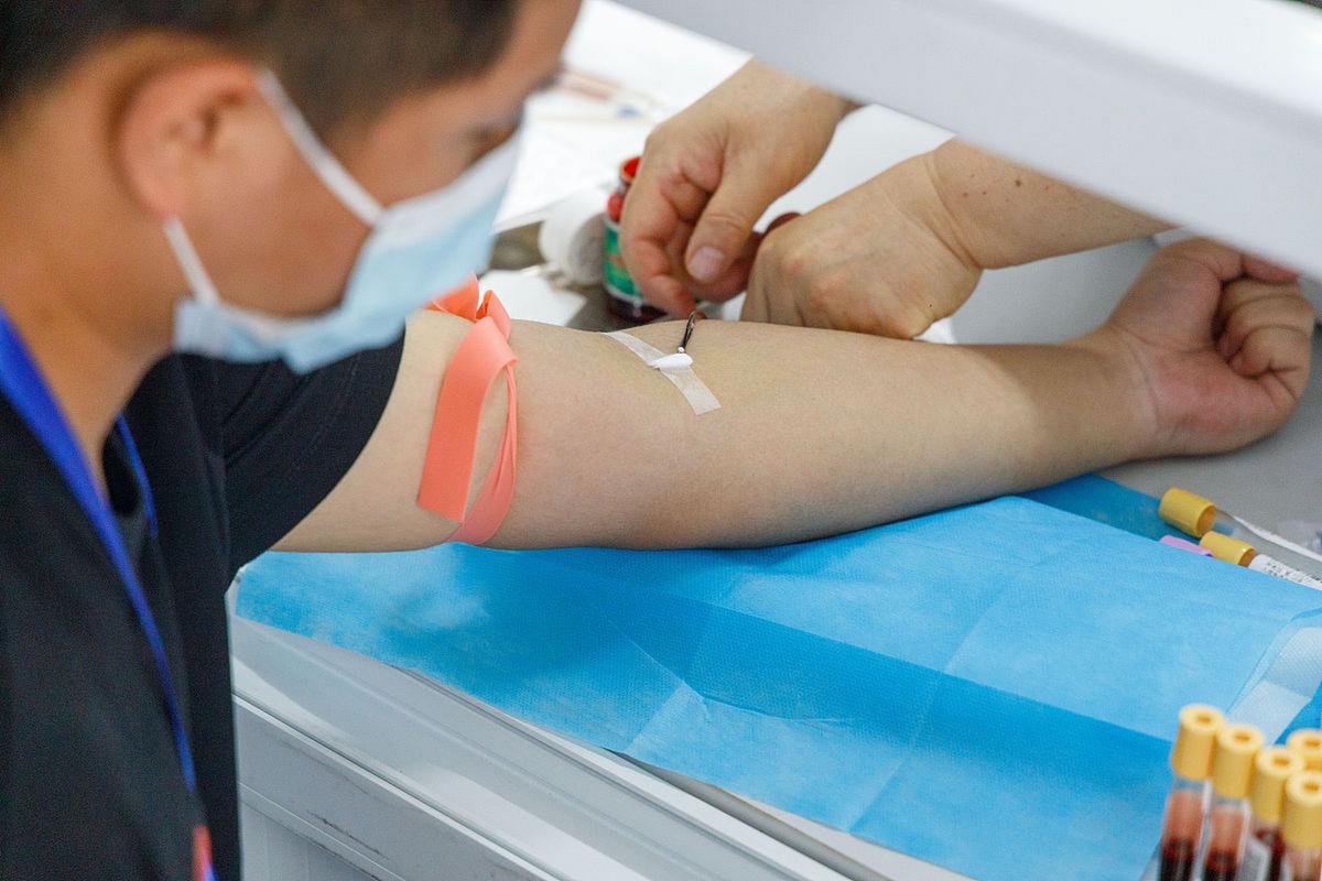 抽血检查风湿 类风湿