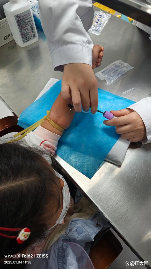 抽血检查风湿 类风湿