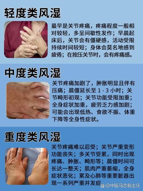 风湿 类风湿那个难治
