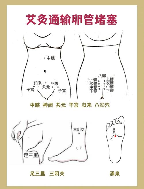 艾灸治疗输卵管穴位图
