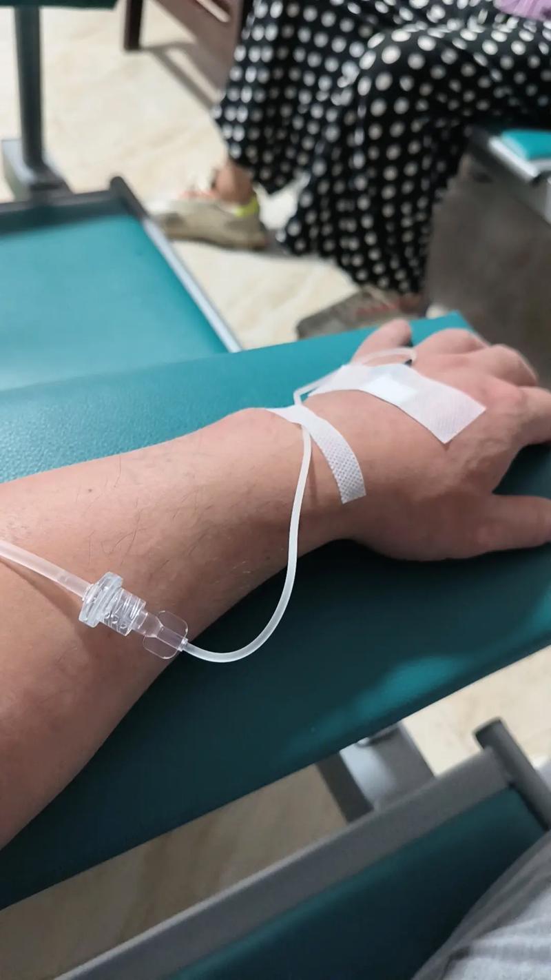 风湿 类风湿输液治疗