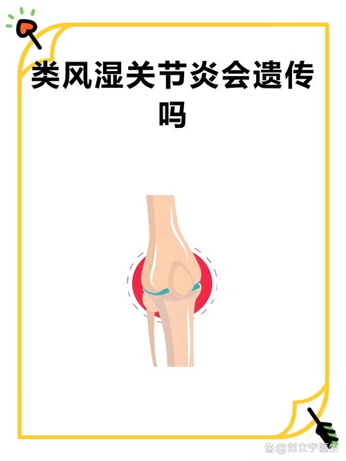 类风湿性关节炎遗传病