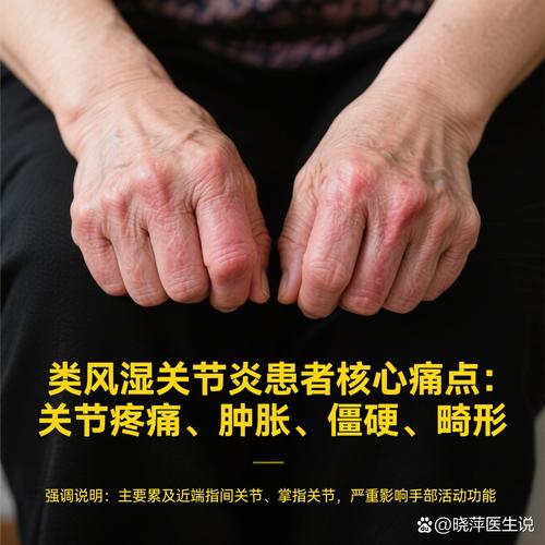 类风湿性关节炎遗传病