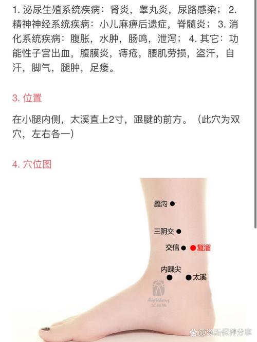 穴位治疗精索静脉曲张