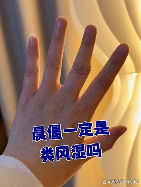 风湿性关节炎有晨僵吗