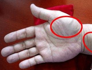 手指风湿 穴位 按摩