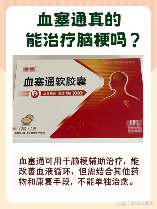 脑安胶囊能治疗脑梗吗