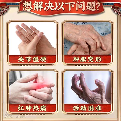 手风湿性关节炎怎么办